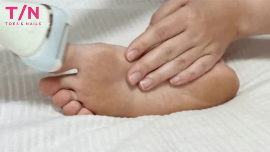 Step by Step Guide to Using a Callus Eliminator for Smooth Heels