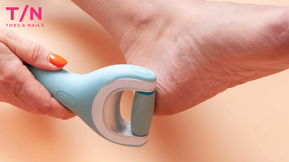 Electric Callus Remover