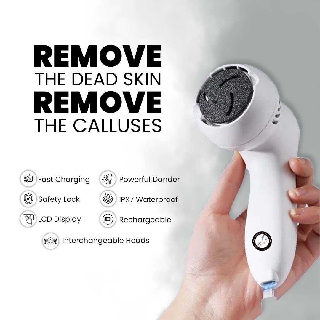 Professional Electric Callus Remover - Your Ultimate Foot Care Solution